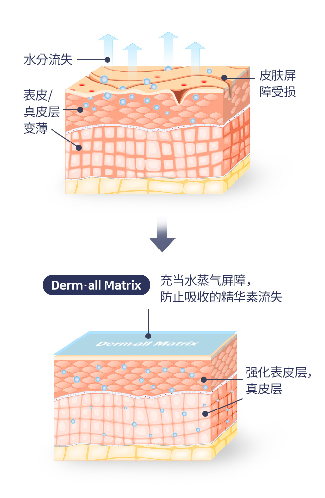 더멀매트릭스