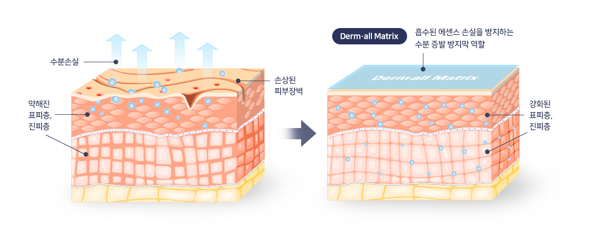 더멀매트릭스