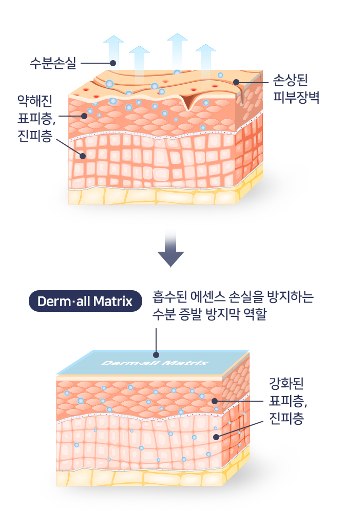 더멀매트릭스